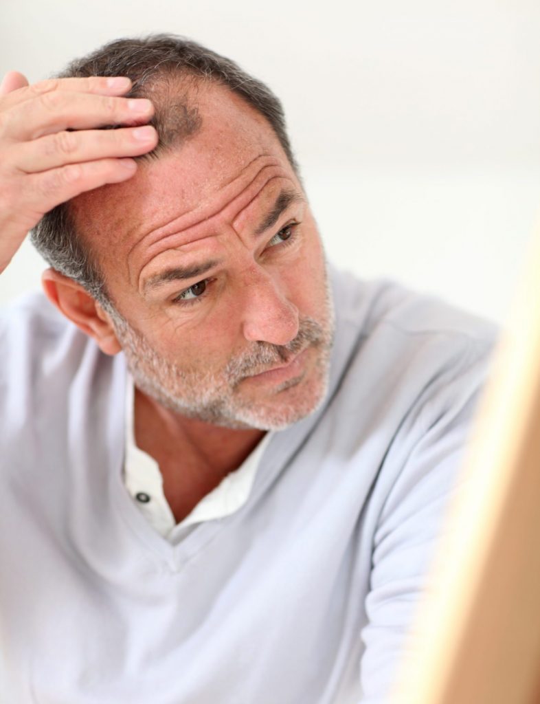 Man touching his thinning hairline